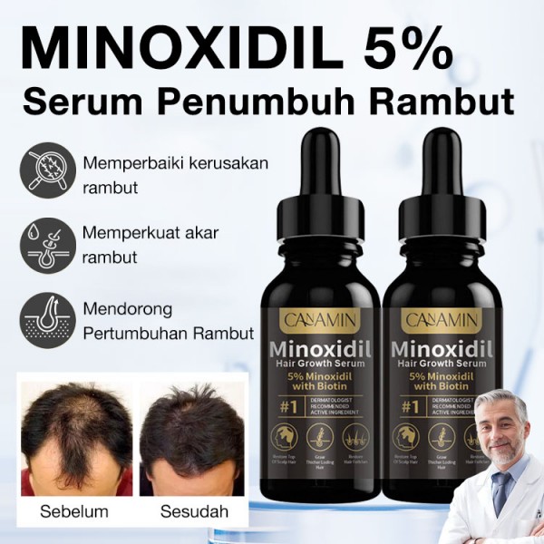 Serum Penumbuh Rambut Minoxidil 5%