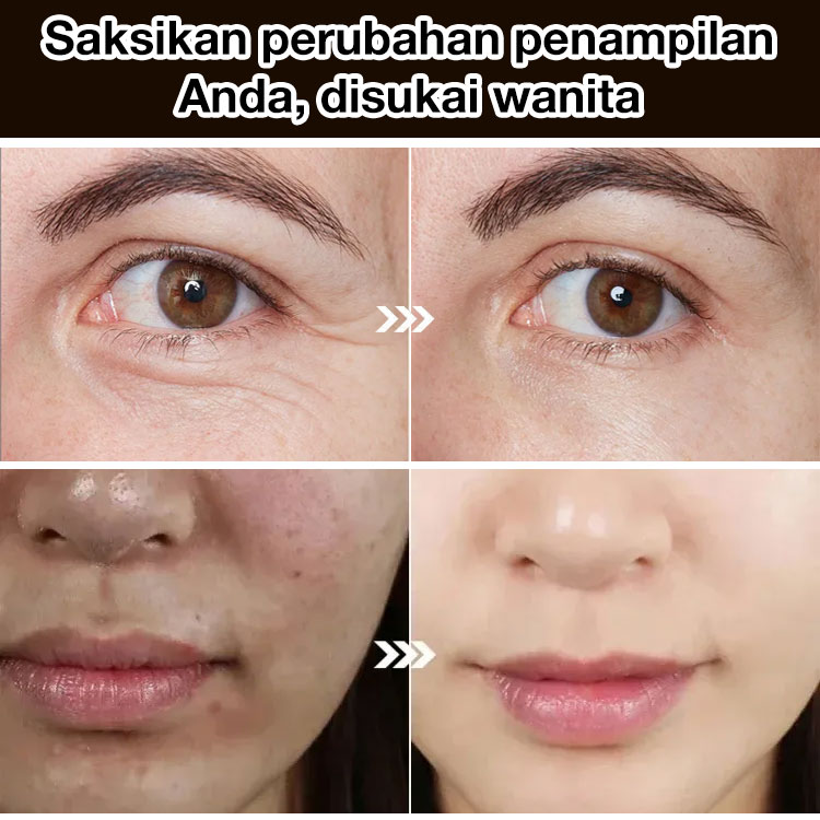 Promo Idul Adha, beli satu gratis satu - Serum Pengencang Anti-Kerutan - Mengurangi Garis-Garis Halus, Mengencangkan Kulit, Melembabkan & Melembabkan untuk Semua Jenis Kulit